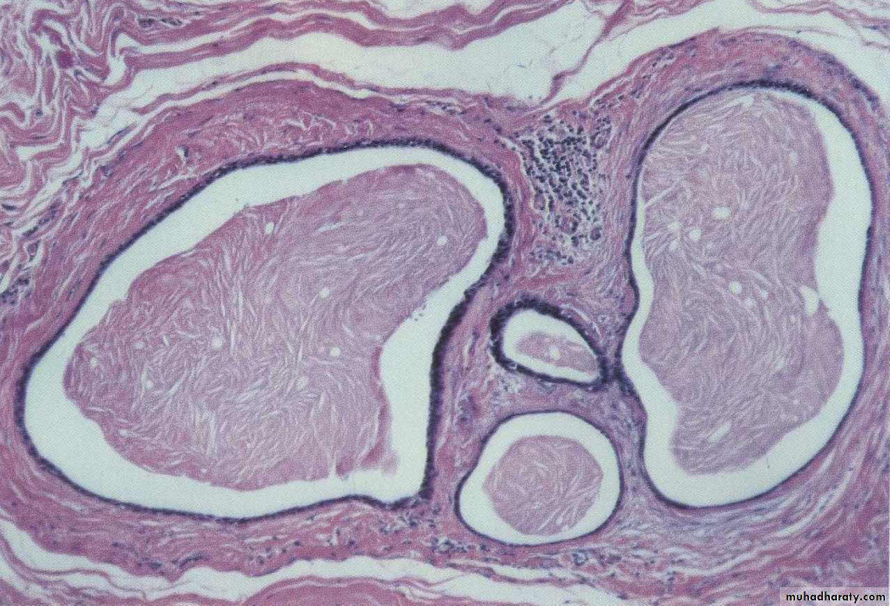 Breast pathology