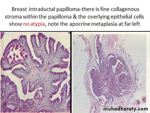Breast pathology