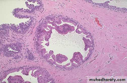 Breast pathology