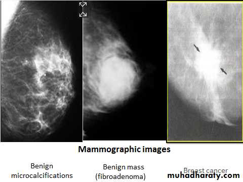 Breast pathology
