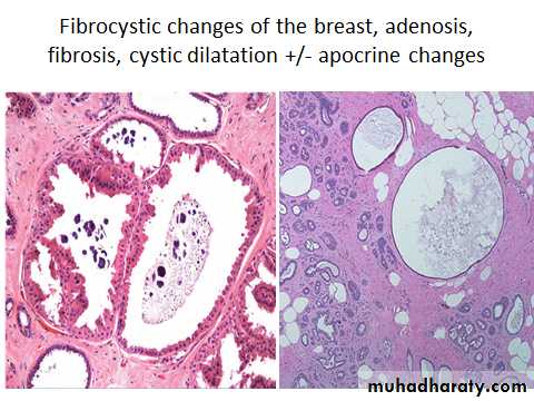 Breast pathology