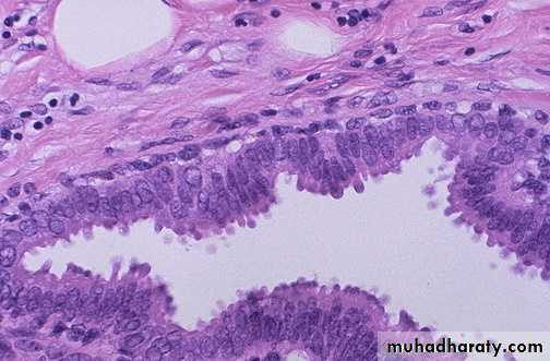 Breast pathology
