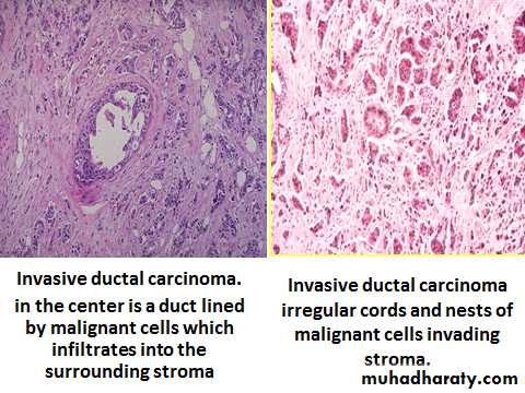Breast pathology 2