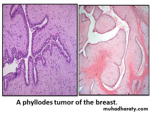 Breast pathology 2