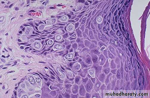 Breast pathology 2