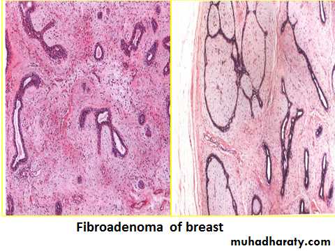 Breast pathology 2