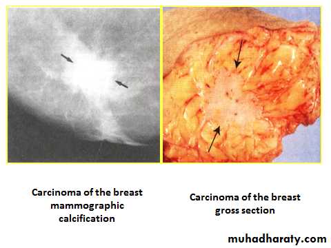 Breast pathology 2
