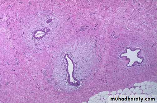 Breast pathology 2