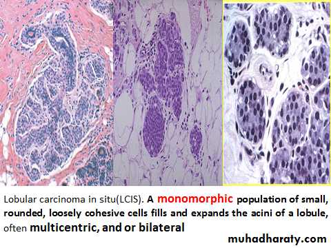 Breast pathology 2