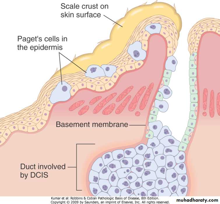 Breast pathology 2