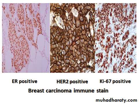 Breast pathology 2