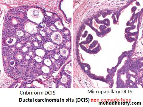 Breast pathology 2