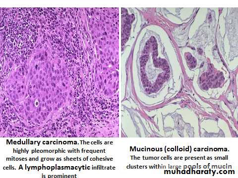 Breast pathology 2