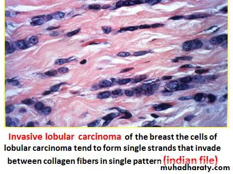Breast pathology 2