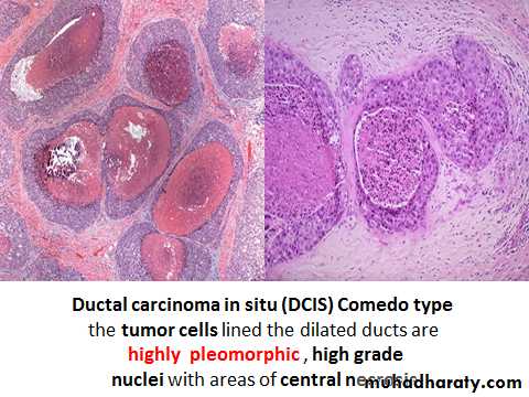 Breast pathology 2
