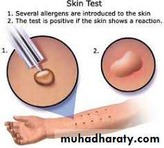 ALLERGY