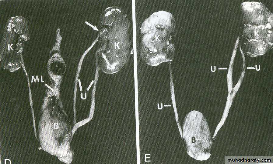 Urogenital system