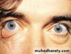 eye lid