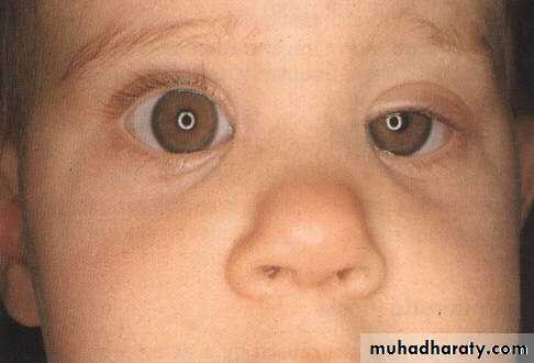 eye lid