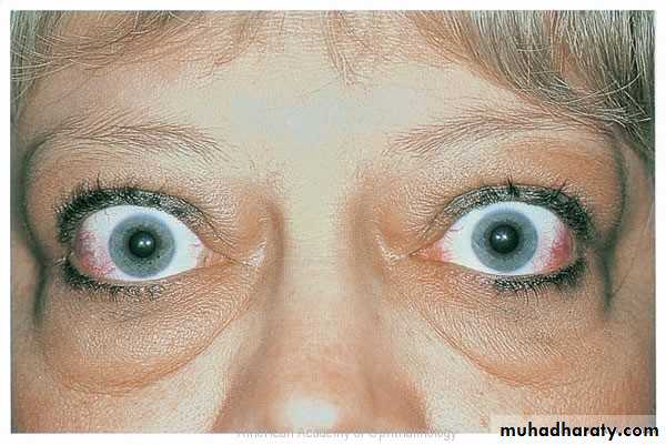 eye lid