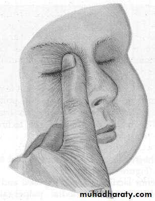 eye lid
