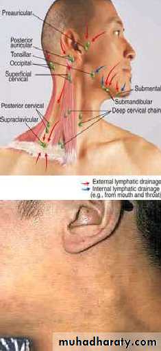 oral cancer