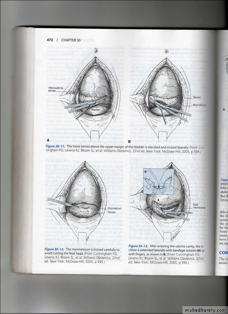 obstetric procedures