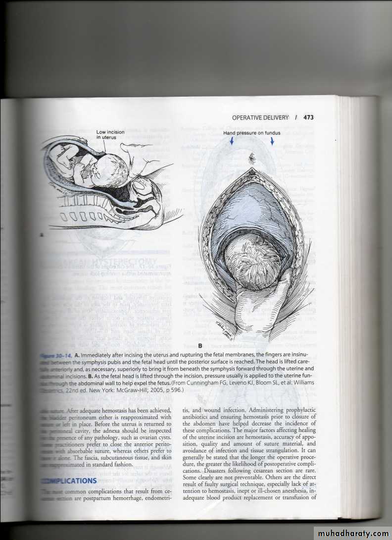 obstetric procedures
