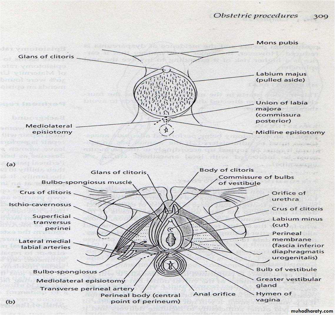 obstetric procedures