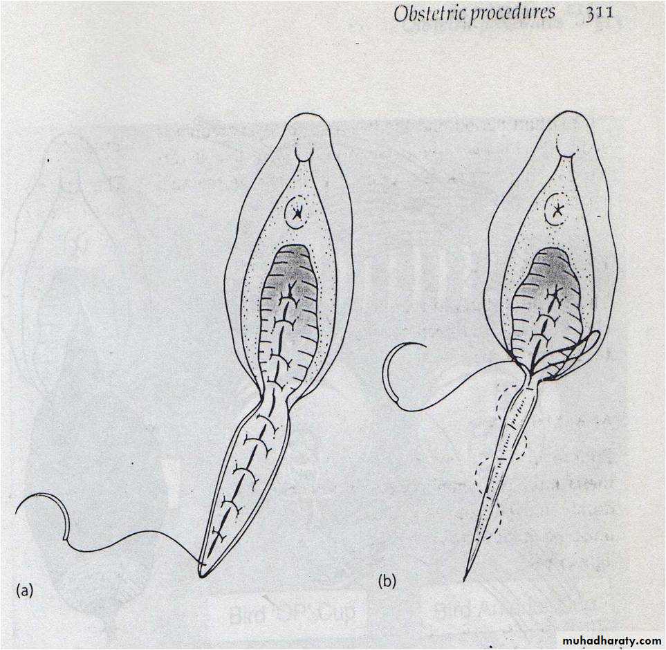 obstetric procedures
