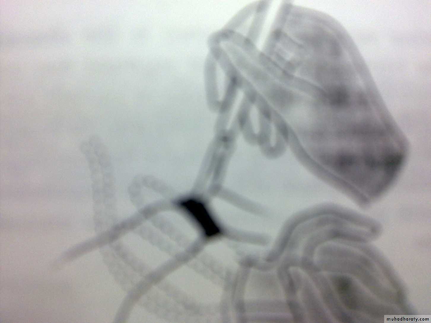 obstetric procedures