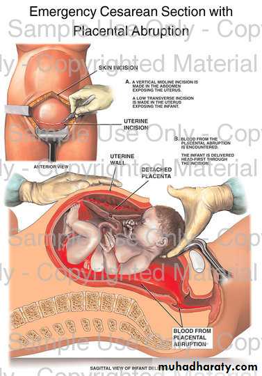 obstetric procedures