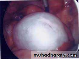 surgical problem