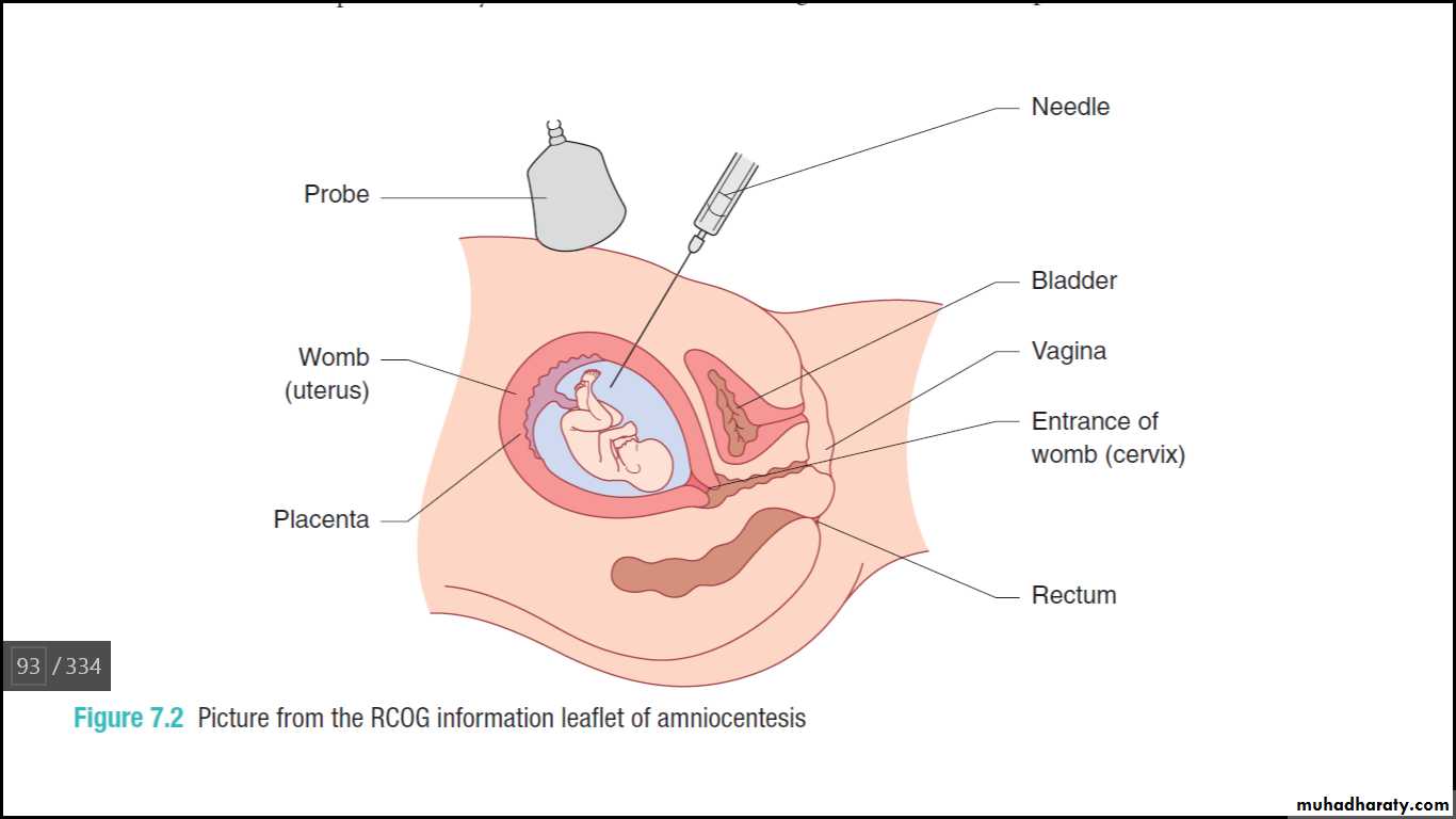 prenatal test
