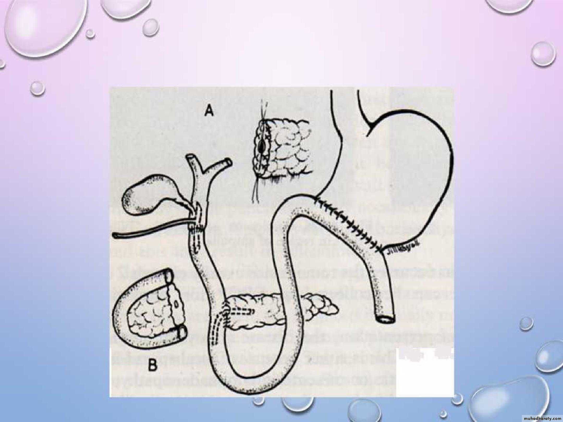 the pancreas