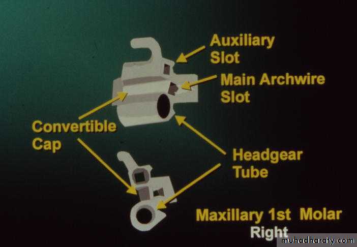 fixed appliance