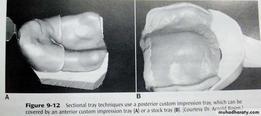 Immediate Denture