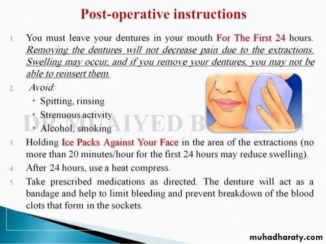 Immediate Denture
