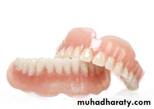 Immediate Denture