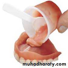 Immediate Denture