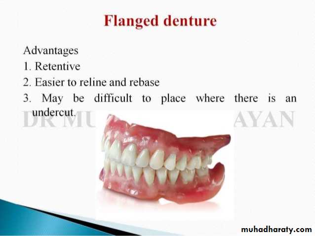 Immediate Denture