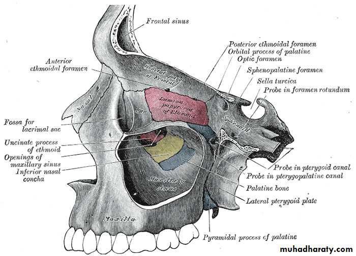 maxillary sinus disease
