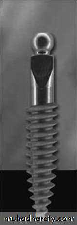 dental implant 2
