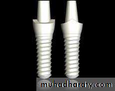 dental implant 2