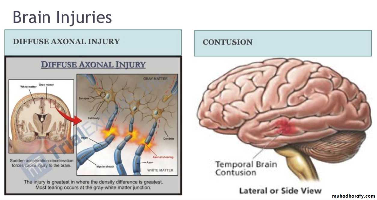 head injury 1