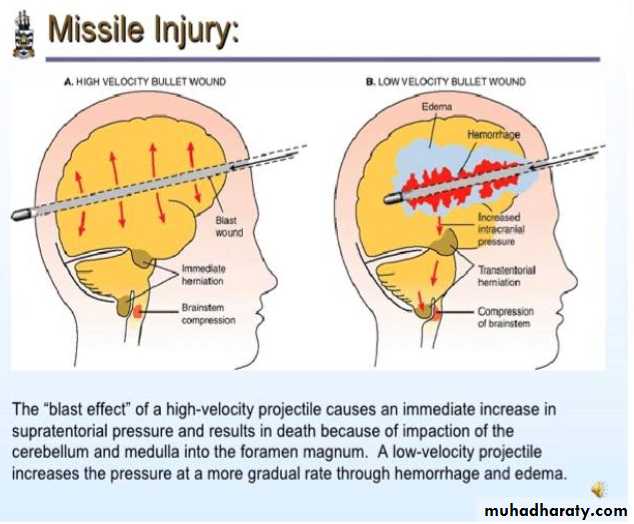 head injury 1