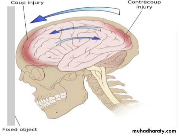 head injury 1