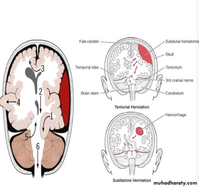 head injury 1