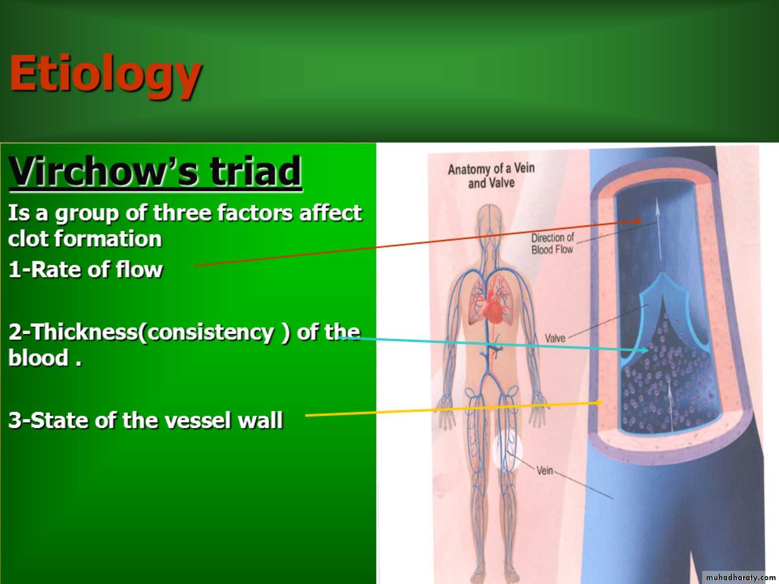 DVT