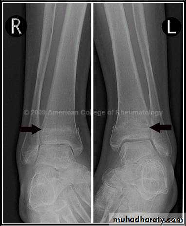 Orthopedics Principle of Fractures